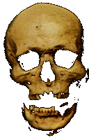 Celtic head trophy. From ancient Gaulish site. 